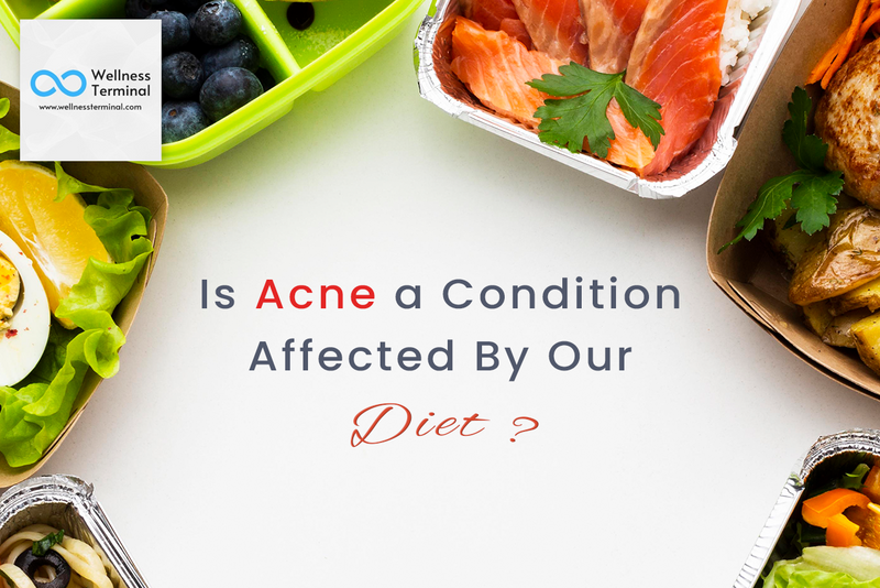 Is Acne a Condition Affected By Our Diet?